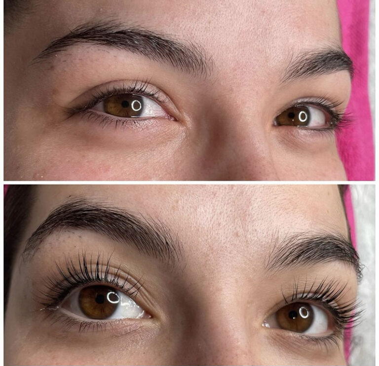 Welcome to Med and Beauty Spa by Eve, nestled in Saint Charles, IL. Our mission is to help you achieve your best look and feel your best. Led by Eve herself, our team of skilled professionals brings together years of experience and a dedication to transformative skincare and body treatments. Whether you’re looking for rejuvenating laser therapies, relaxing facials, or indulgent body treatments such as massages and wraps, each service is personalized to suit your unique needs. We pride ourselves on using advanced technology that surpasses other spas in the area, ensuring you receive the most effective treatments available.