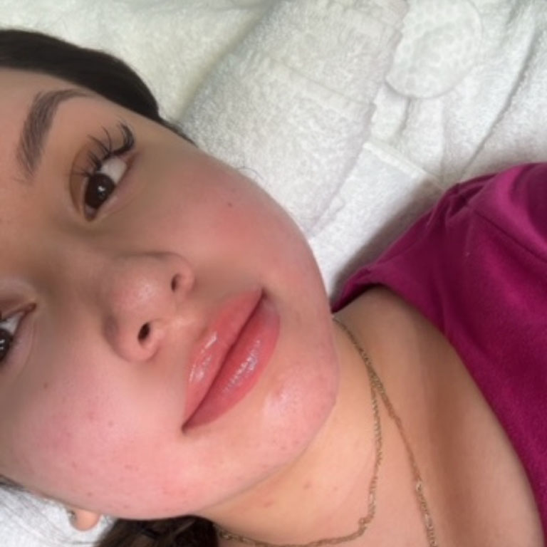 Welcome to Med and Beauty Spa by Eve, nestled in Saint Charles, IL. Our mission is to help you achieve your best look and feel your best. Led by Eve herself, our team of skilled professionals brings together years of experience and a dedication to transformative skincare and body treatments. Whether you’re looking for rejuvenating laser therapies, relaxing facials, or indulgent body treatments such as massages and wraps, each service is personalized to suit your unique needs. We pride ourselves on using advanced technology that surpasses other spas in the area, ensuring you receive the most effective treatments available.